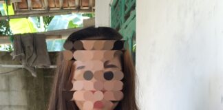 Dugaan Penganiayaan Brutal di SGC Cikarang: Pelaku (R) Masih Bebas, Firma Hukum KCBI Desak Kepolisian Bertindak Tegas