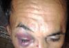 Kasus Pengeroyokan Warga di Banggai Laut Melibat Anggota Polri: Polres Mulai Usut Terlapor
